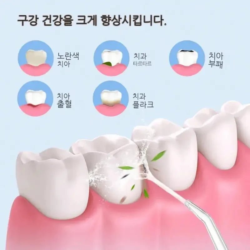 SmartChip Water Flosser - Precise Pressure & 360° Nozzle - Nordshop Hamburg