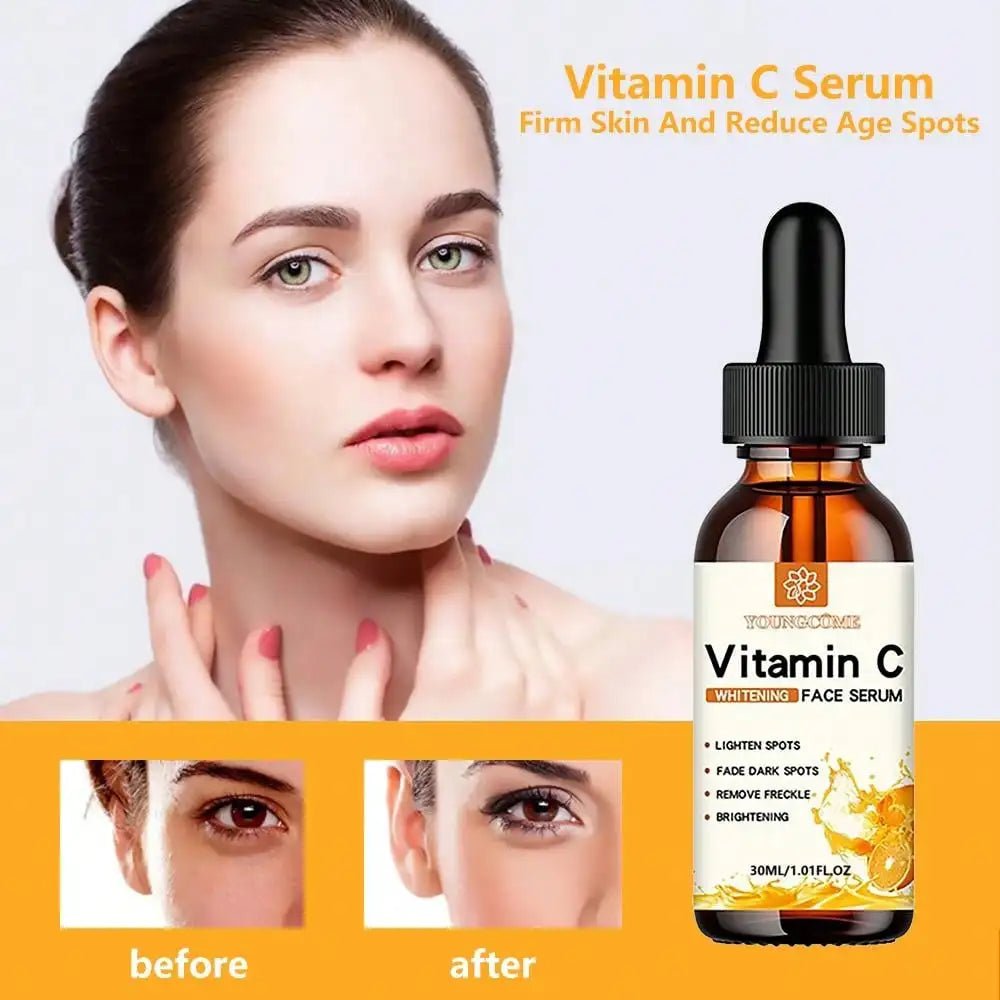 Vitamin C Brightening Essence - Dark Spot Remover & Anti - Aging Moisturizer - Nordshop Hamburg