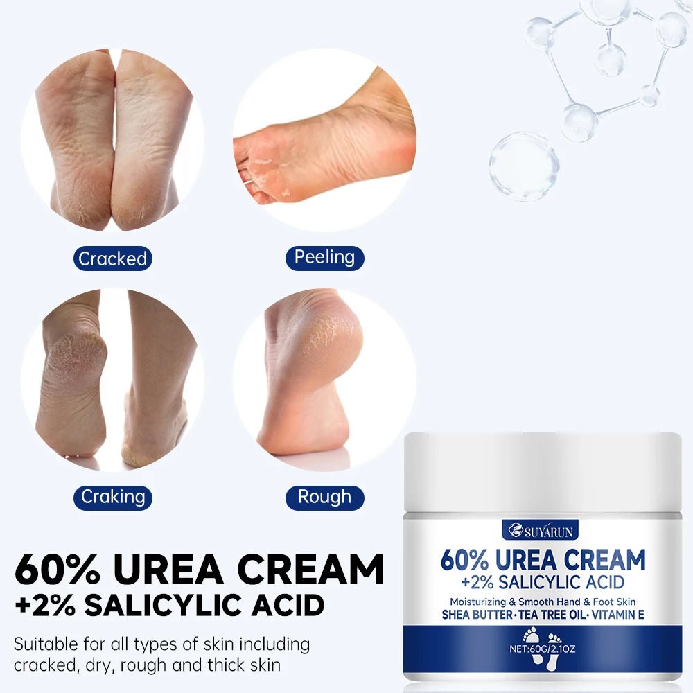 SUYARUN 60% Urea Cream: Multi - Action Power for Face & Feet - Nordshop Hamburg