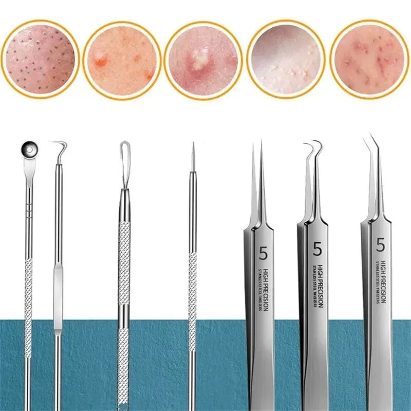 6 - in - 1 Precision Pimple & Blackhead Remover Kit - Professional Skin Care Tools - Nordshop Hamburg