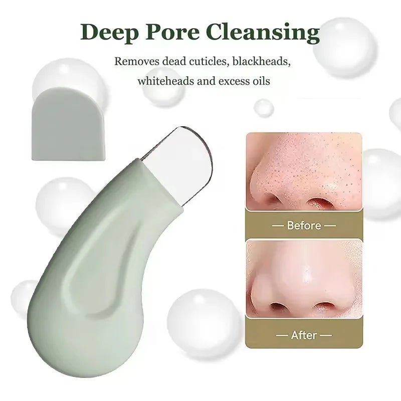 Precision Pore Cleaner Tool - Blackhead & Whitehead Remover for Face and Nose - Nordshop Hamburg